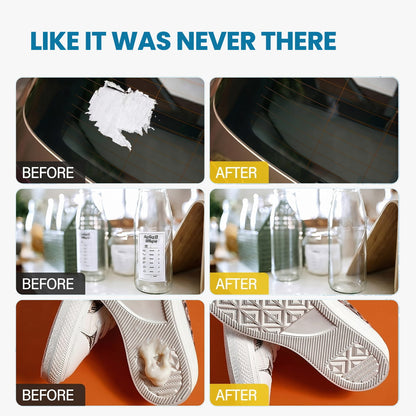 Adhesive Remover Kit